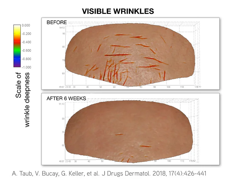 3D skin scans of visible wrinkles before and after 6 weeks, with fewer wrinkles after